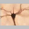 Neuronas Golgi 11.jpg
